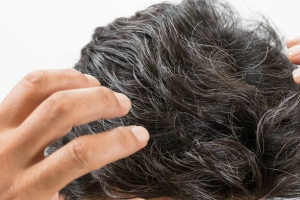 با این روش موهای سفید از بین می‌روند؟ | دلایل سفید شدن مو