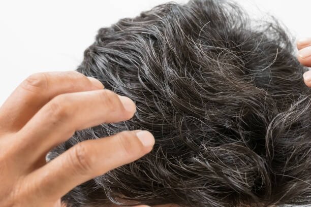 با این روش موهای سفید از بین می‌روند؟ | دلایل سفید شدن مو